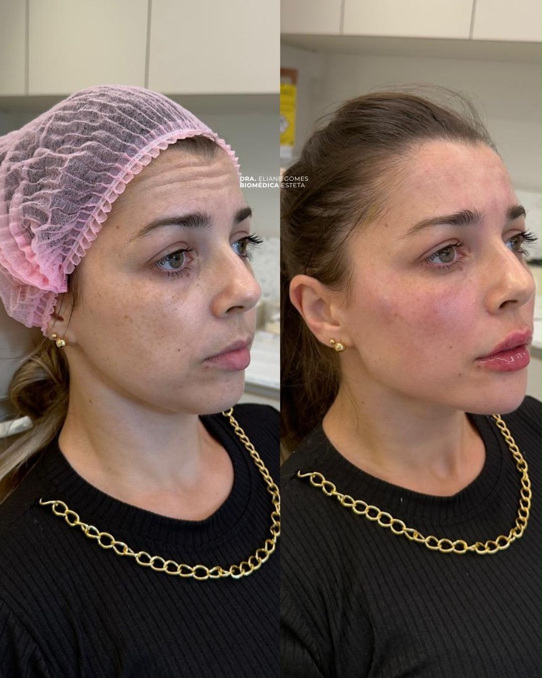 Antes & Depois 01