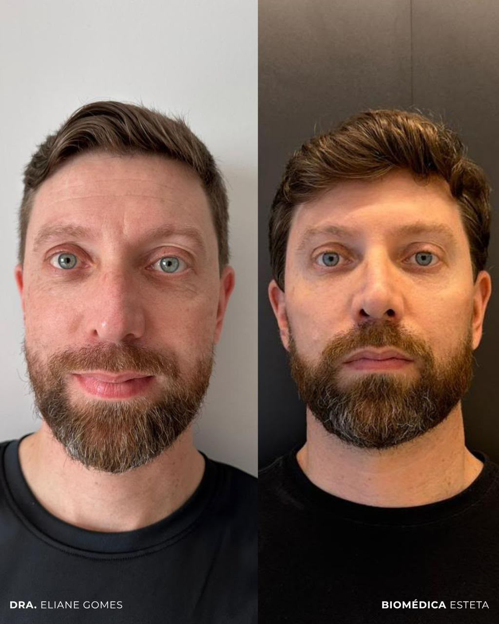 Antes & Depois 02