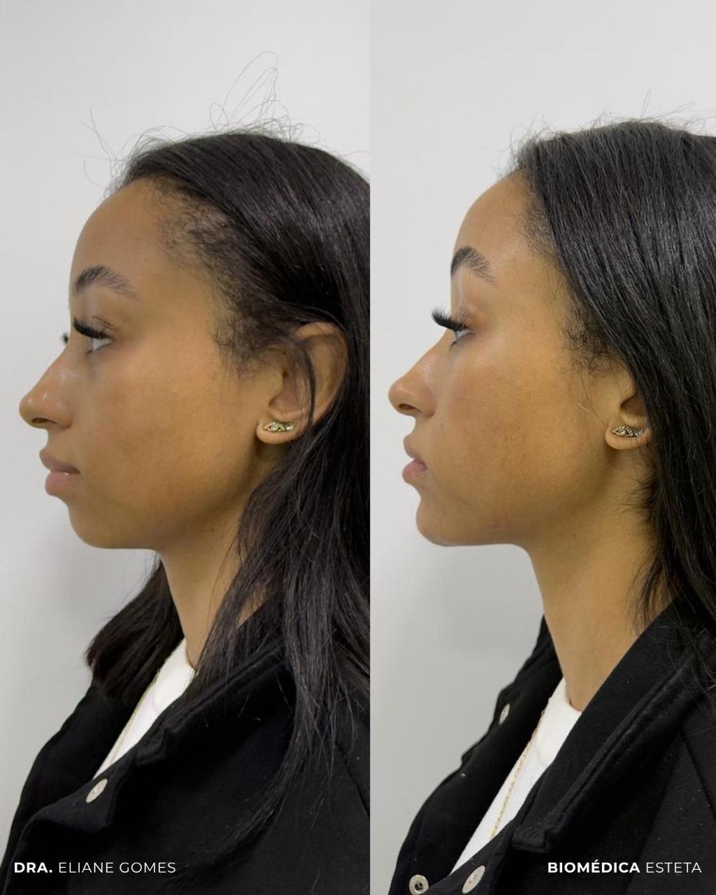 Full Face